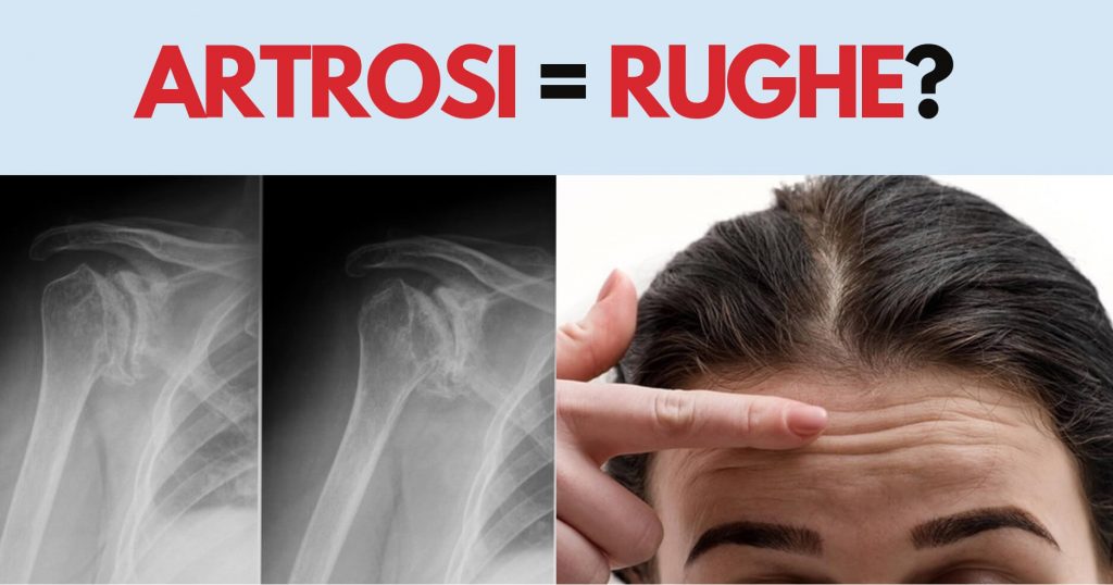 Artrosi uguale alle rughe