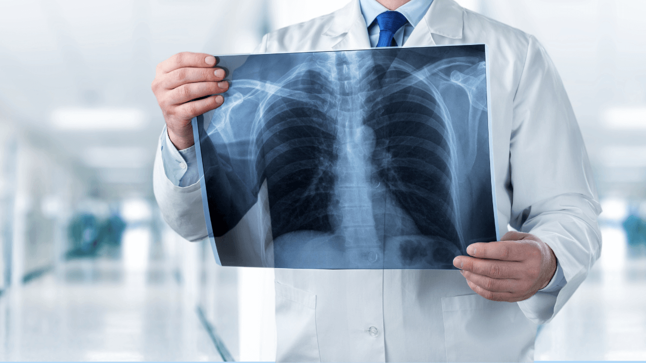 Radiografia alla spalla Rx alla spalla