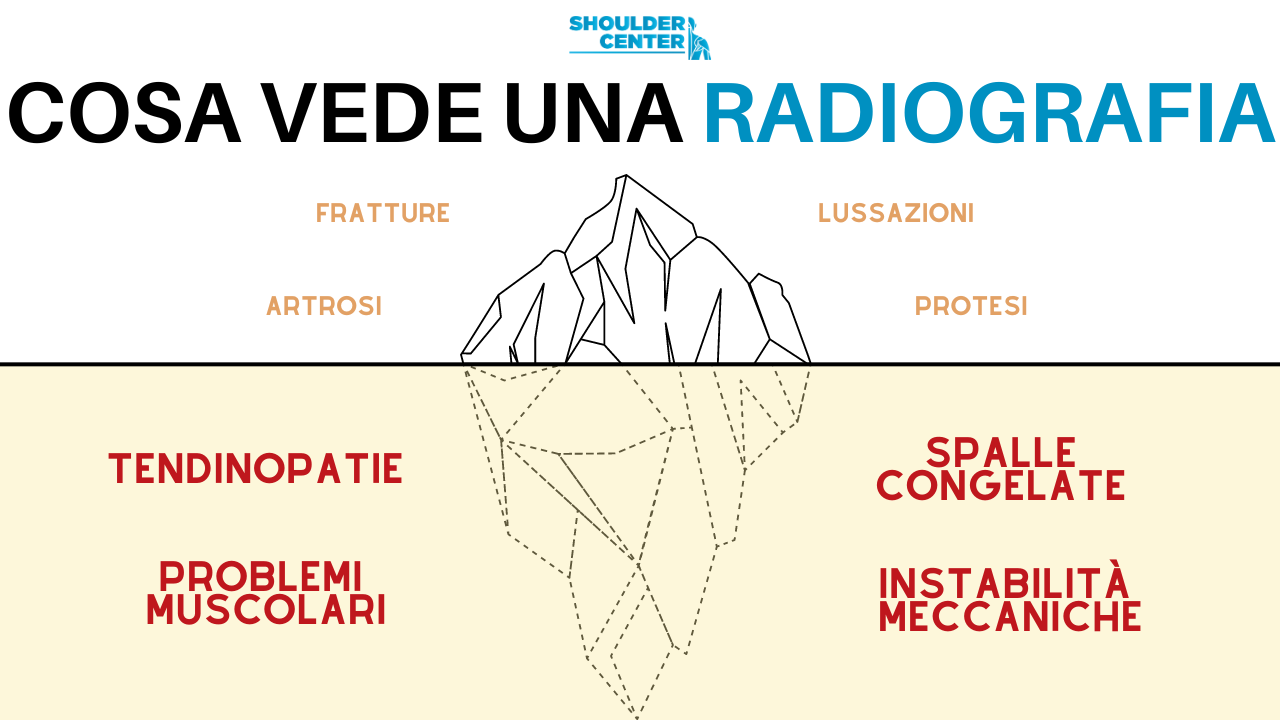 Cosa vede una rx alla spalla