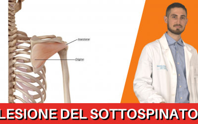Lesione del sottospinato, Guida Completa e consigli PRATICI.