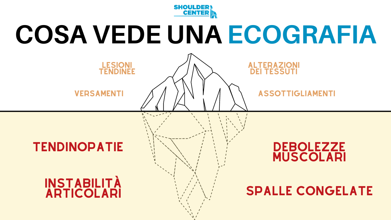Ecografia alla spalla: che cosa si vede