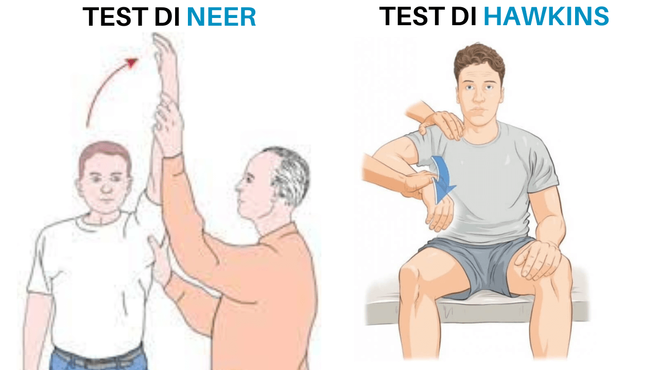 Impingement alla spalla - test diagnostici