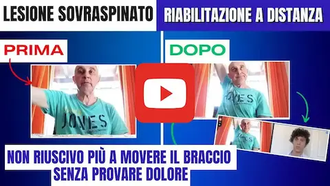 Testimonianza riabilitazione alla spalla di Giuseppe Fiocchi