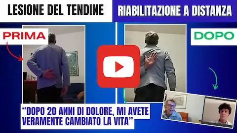Video testimonianza riabilitazione alla spalla: Maurizio Lanza
